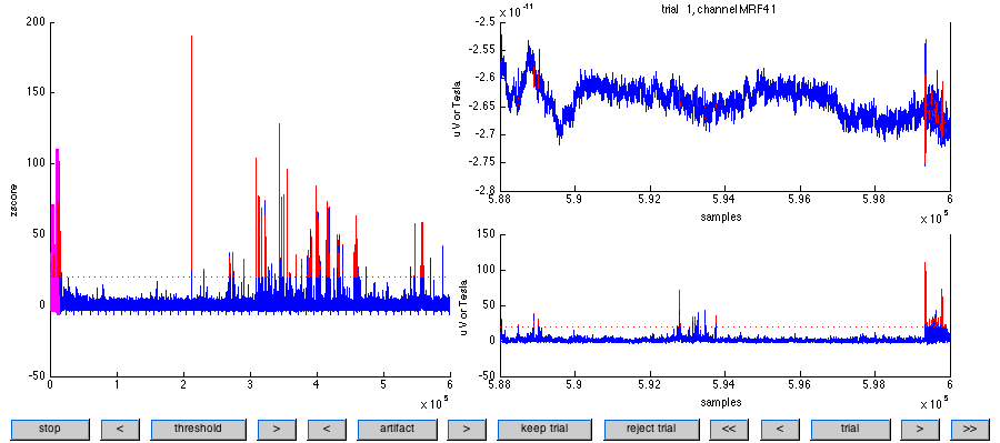 ft_artifact_zvalue 的交互图。左侧面板显示已处理数据的 z-score 以及阈值。超阈值数据点标记为红色。右下面板显示特定试次的已处理数据的 z-score，右上面板显示对（累积）z-score 贡献最大的通道的未处理数据。您可以使用图底部的按钮浏览试次。此外，您可以调整阈值，并手动保留 / 拒绝试次。