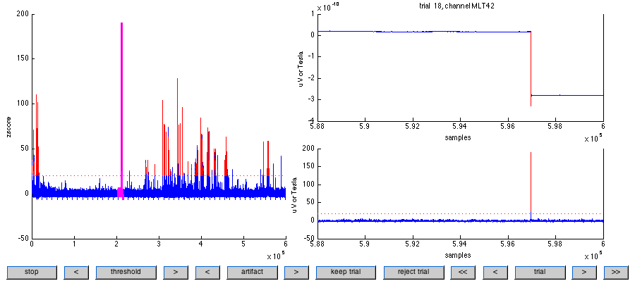 典型的 SQUID 跳跃可以在通道 MLT42 上观察到，试次 18。