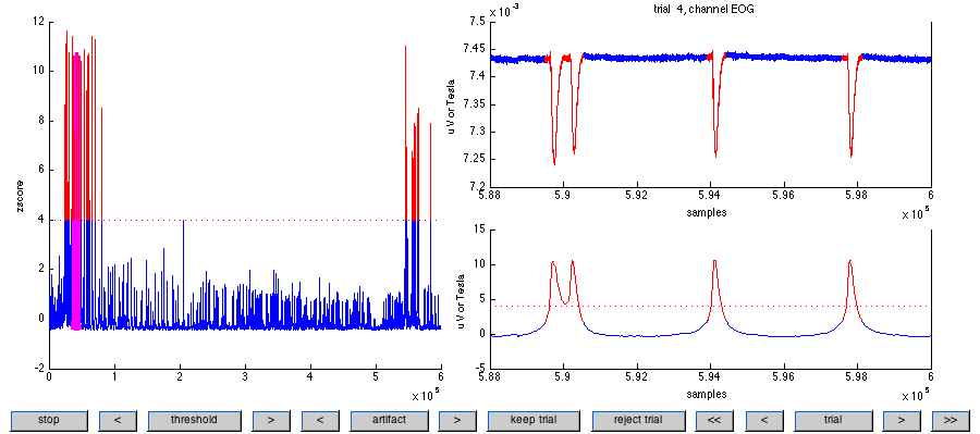 在试次 4 中可以观察到典型的眨眼伪影。请注意，试次认为伪影先于阈值交叉并持续时间超过阈值交叉，方法是在左侧填充 0.1 秒，在右侧填充 0.1 秒