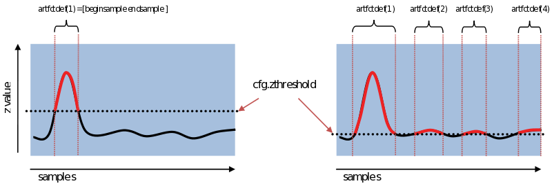 图：设置更高或更低的 z 值阈值将使伪影的检测更加保守或自由